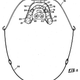 Illustration for article titled 10 of Historys Weirdest Medical and Scientific Patents